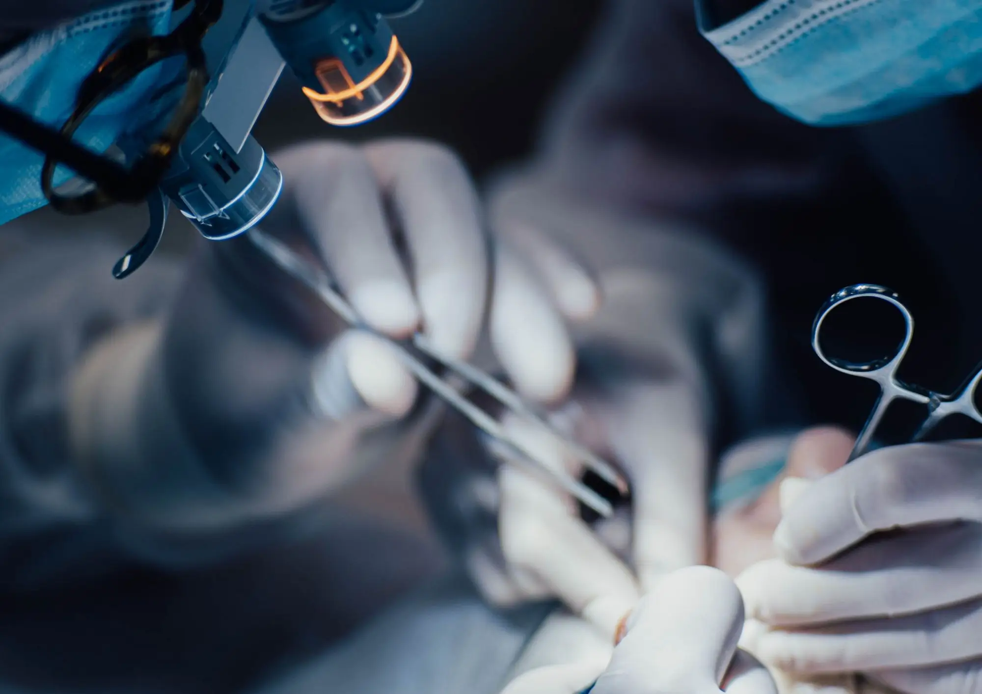 microsurgery (1) Denerwacja jądra to szansa na zachowanie jądra i uniknięcie orchidektomii, czyli całkowitego usunięcia jądra.