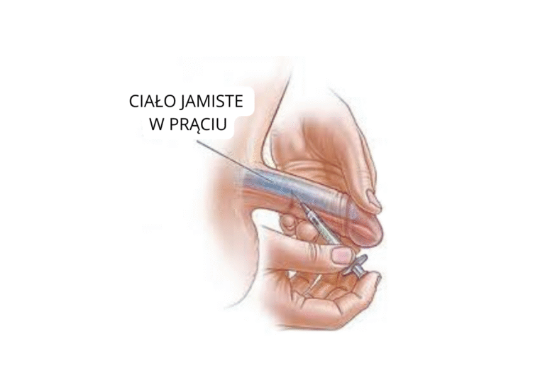 CIAŁO JAMISTE W PRĄCIU (8) Farmakoterapia w leczeniu zaburzeń erekcji